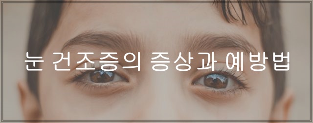 눈 건조증의 증상과 예방법